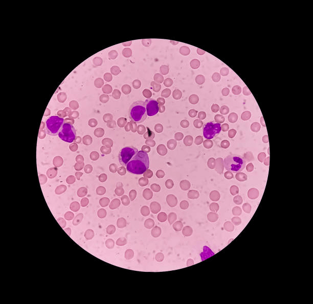 best surgical oncologist in Gurgaon